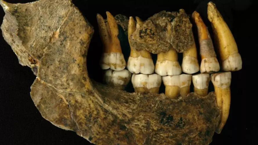 Showing maxilla and mandible assemblage of a late Neanderthal