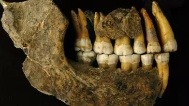 Showing maxilla and mandible assemblage of a late Neanderthal